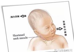 平衡自然光与人工光在城市街拍中的运用